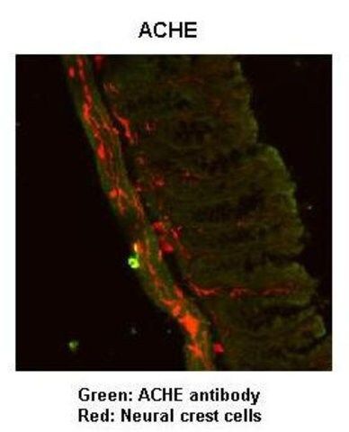 Anti-ACHE, (N-terminal) antibody produced in rabbit