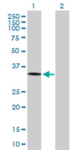 Anti-ACP5 antibody produced in mouse