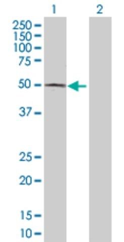 Anti-ACP6 antibody produced in rabbit