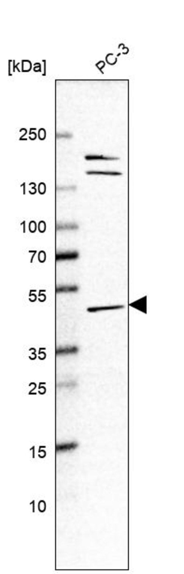 Anti-ACP6 antibody produced in rabbit