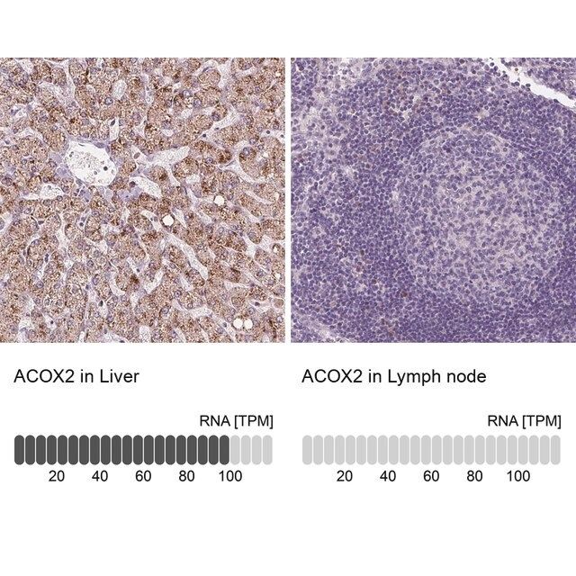 Anti-ACOX2 antibody produced in rabbit