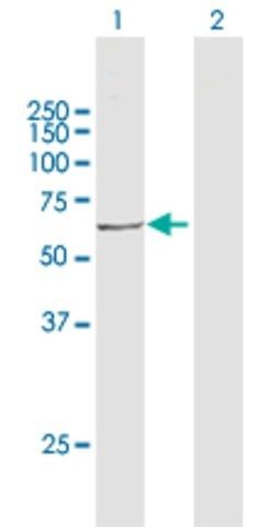 Anti-ACOX3 antibody produced in rabbit