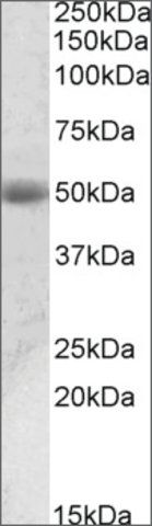 Anti-ACPP antibody produced in goat