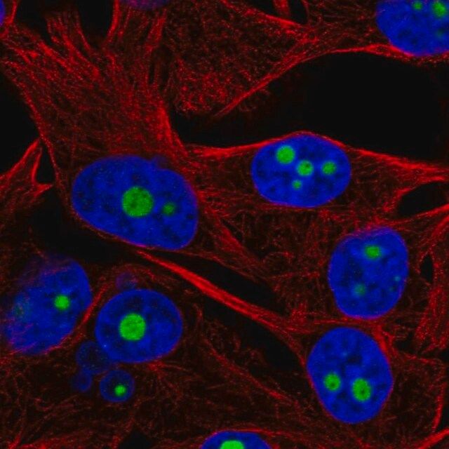 Anti-ACTR10 antibody produced in rabbit