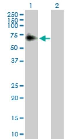 Anti-ACP2 antibody produced in rabbit