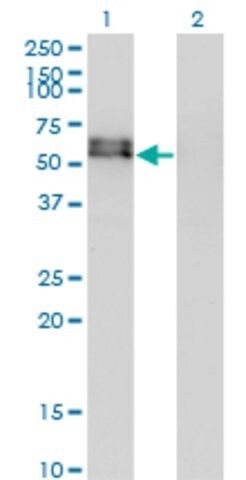 Monoclonal Anti-ACVR1 antibody produced in mouse