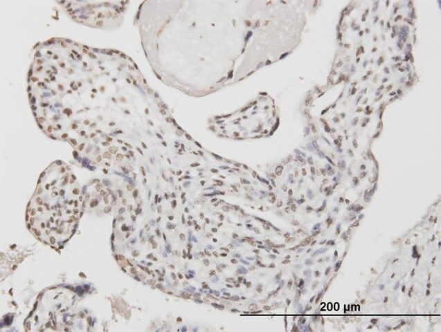 Monoclonal Anti-ATF1 antibody produced in mouse