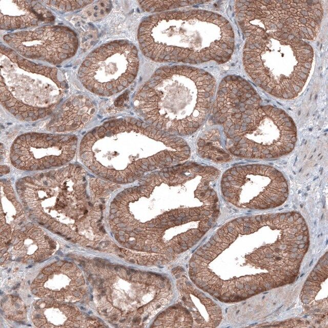 Monoclonal Anti-BRAF antibody produced in mouse