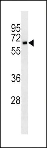 MONOCLONAL ANTI-CD25 antibody produced in mouse