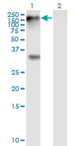 Monoclonal Anti-EPHB1 antibody produced in mouse