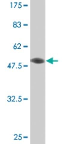 Monoclonal Anti-ETV4 antibody produced in mouse