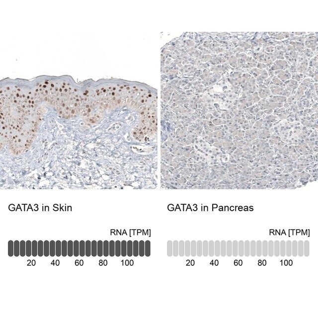 Monoclonal Anti-GATA3 antibody produced in mouse