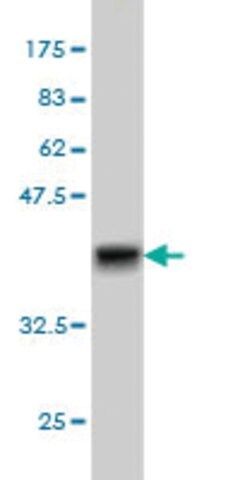 Monoclonal Anti-GRK4 antibody produced in mouse