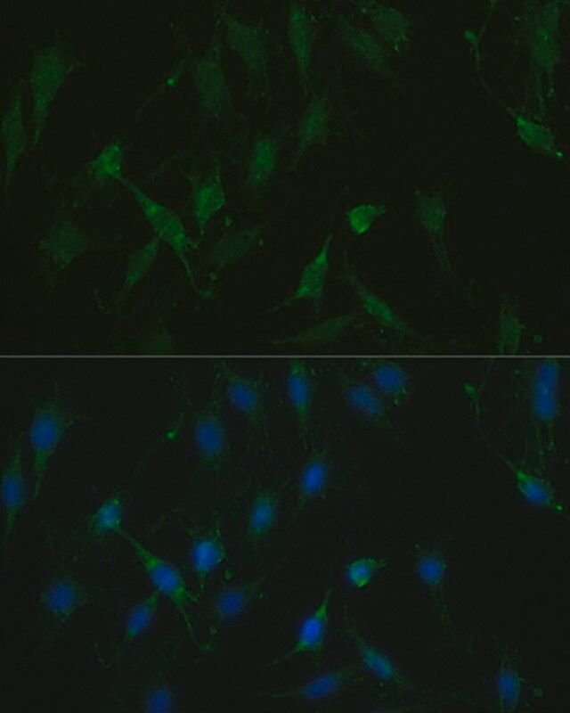 Anti-TRPV1 antibody produced in rabbit