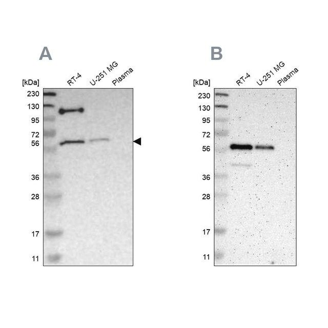 Anti-TRAF2 antibody produced in rabbit