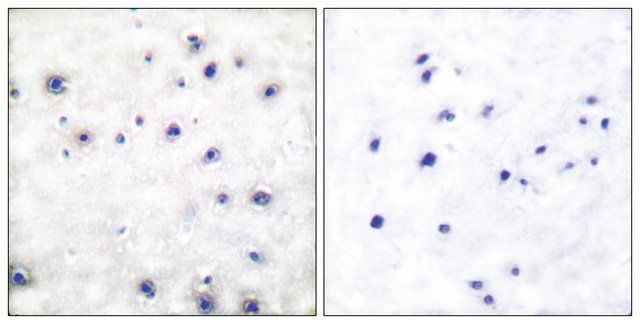 Anti-TRK A antibody produced in rabbit