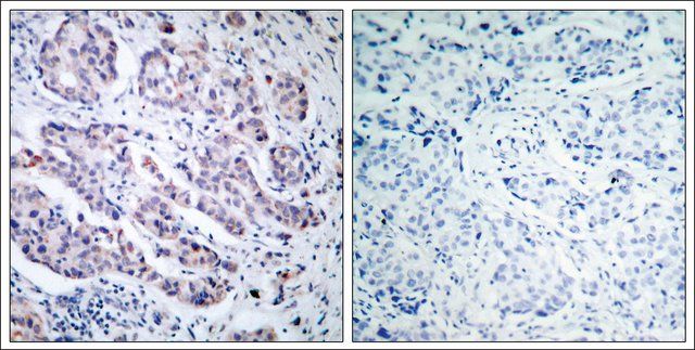 Anti-TYK2 (Ab-1054) antibody produced in rabbit