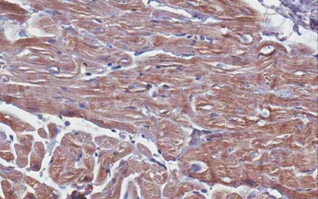 Anti-Troponin T (Cardiac Muscle) Antibody, clone 9C2.1