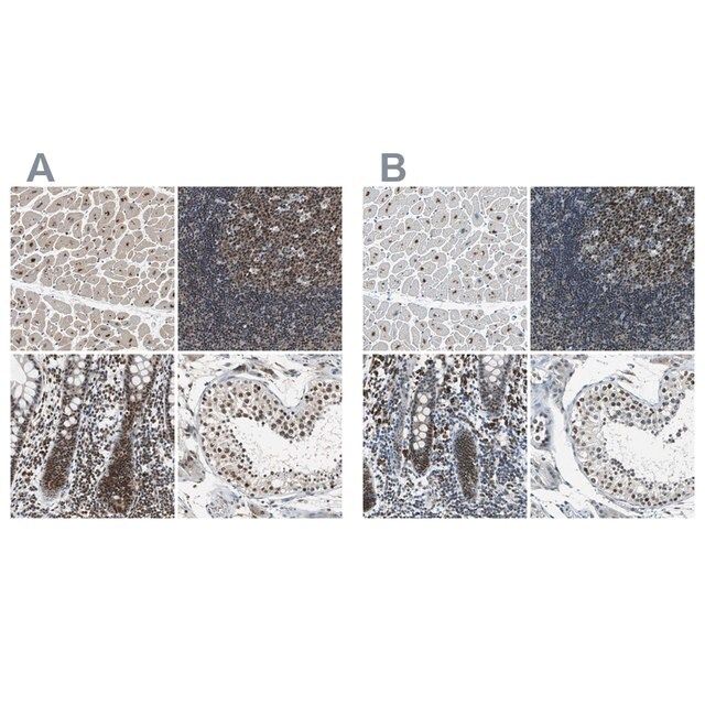 Anti-USP28 antibody produced in rabbit