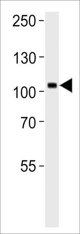 ANTI-TRKC antibody produced in rabbit