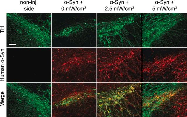 Anti-Tyrosine Hydroxylase Antibody