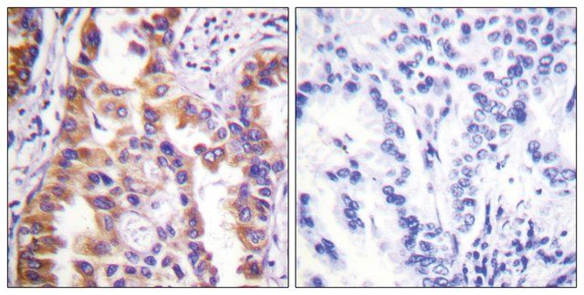 Anti-TSC2 antibody produced in rabbit