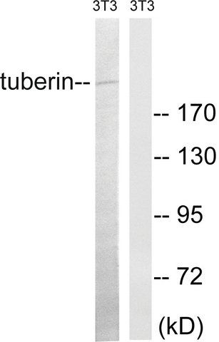 Anti-Tuberin antibody produced in rabbit