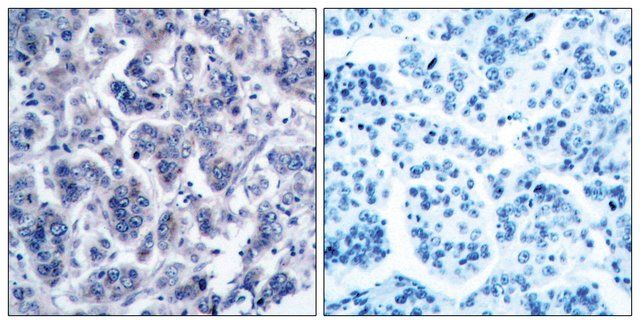 Anti-TYK2 antibody produced in rabbit