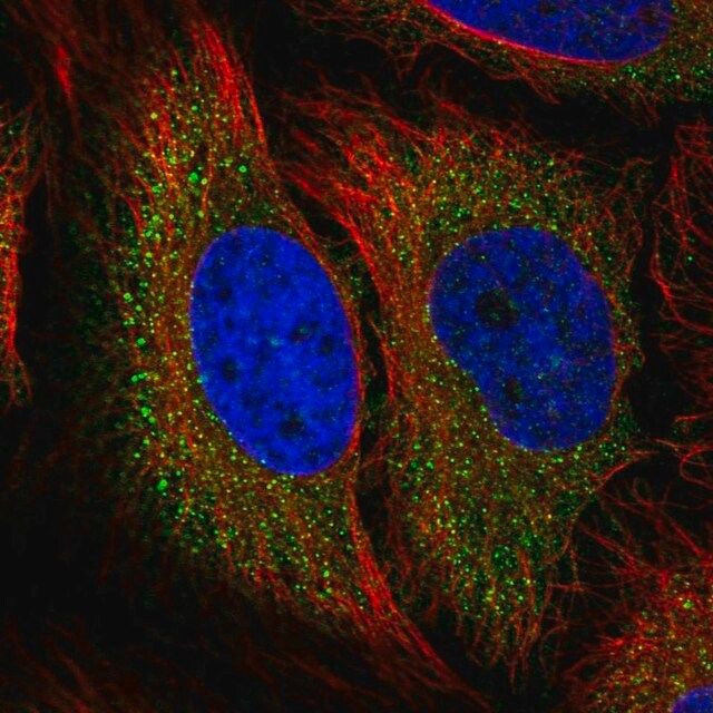 Anti-TSC2 antibody produced in rabbit