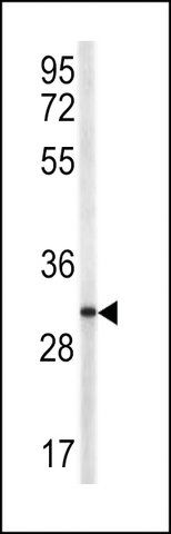 ANTI-TRAP(N-TERMINAL) antibody produced in rabbit