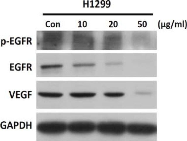 Anti-VEGF Antibody