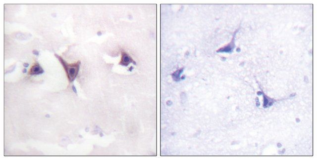 Anti-TRK B antibody produced in rabbit