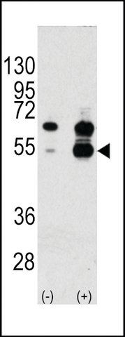 ANTI-VEGF1(N-TERMINAL) antibody produced in rabbit