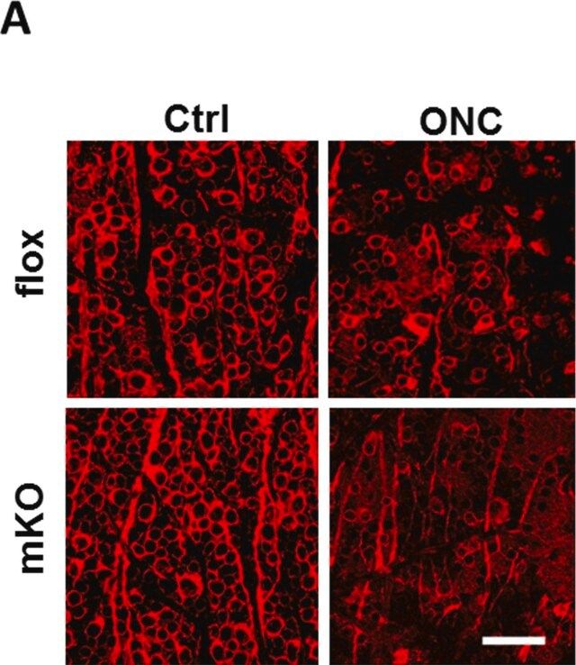 Anti-Tubulin  III Antibody