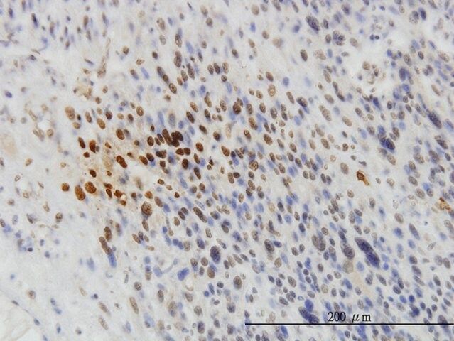 ANTI-TYK2 antibody produced in mouse