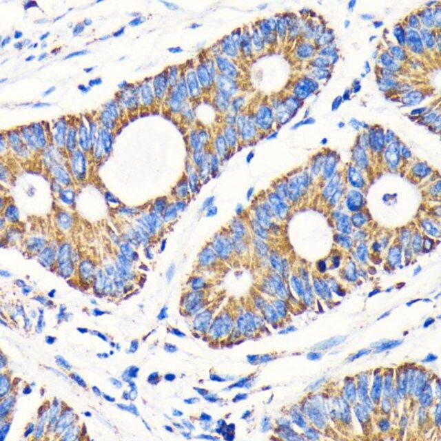 Anti-VDAC1 antibody produced in rabbit