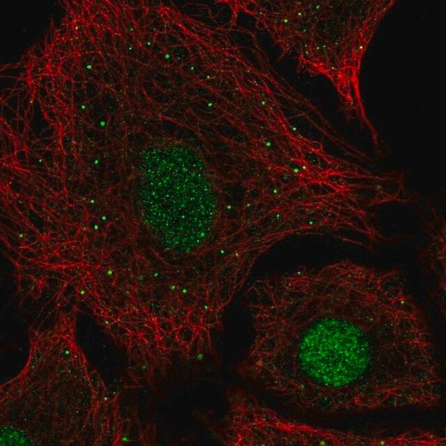 Anti-USF2 antibody produced in rabbit