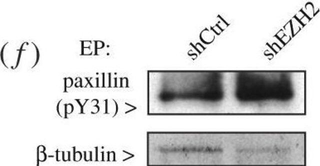 Anti-Tubulin Antibody, beta, clone KMX-1