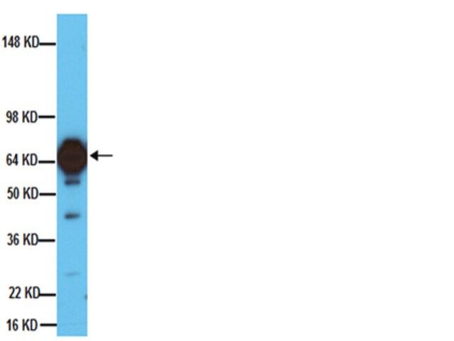 Anti-Tyrosine Hydroxylase Antibody, clone 2/40/15