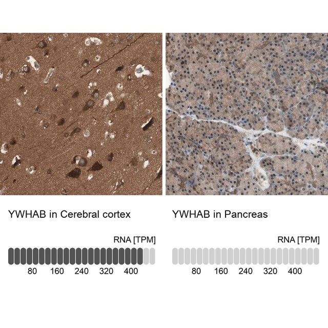 Anti-YWHAB antibody produced in rabbit