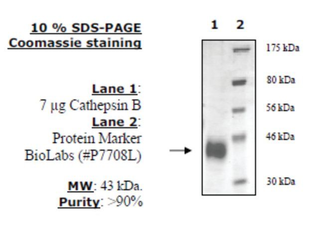 Cathepsin B Active human