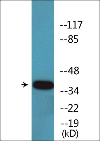 Anti-phospho-MKP-1/2 (pSer<sup>296/318</sup>) antibody produced in rabbit