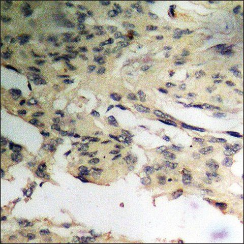 Anti-phospho-p27 Kip1 (pThr<sup>198</sup>) antibody produced in rabbit