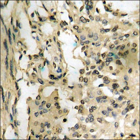 Anti-phospho-p38 MAPK (pTyr<sup>182</sup>) antibody produced in rabbit