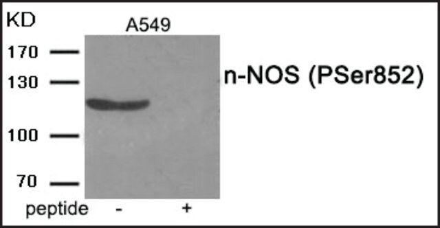 Anti-phospho-n-NOS (pSer<sup>852</sup>) antibody produced in rabbit