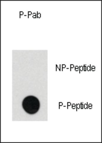 Anti-Phospho-RASGRF1-S929 antibody produced in rabbit