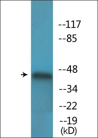 Anti-phospho-p44/42 MAP Kinase (pThr<sup>202</sup>) antibody produced in rabbit