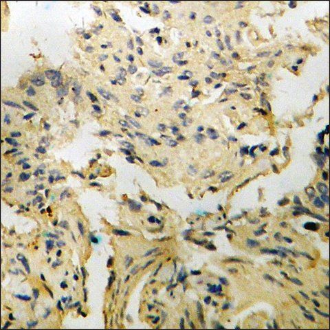 Anti-phospho-p130 Cas (pTyr<sup>410</sup>) antibody produced in rabbit