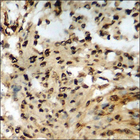 Anti-phospho-Retinoblastoma (pSer<sup>807</sup>) antibody produced in rabbit