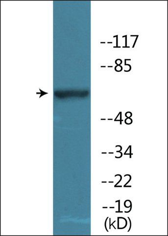 Anti-phospho-WEE1 (pSer<sup>642</sup>) antibody produced in rabbit